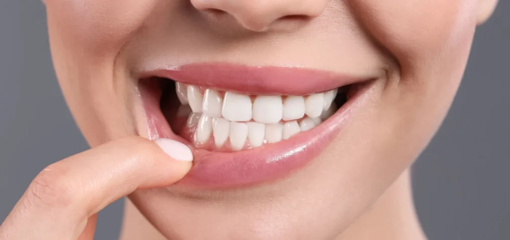 soins gencives detartrage Parodontite et vos gencives Chirurgien-dentiste Alby-sur-Chéran - Dr Paulin CARTIER