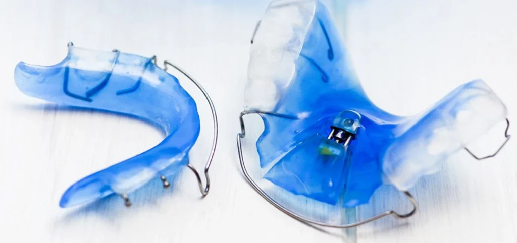 plaque palatine enfants plaque palatine enfants Orthodontie Chirurgien-dentiste Alby-sur-Chéran - Dr Paulin CARTIER